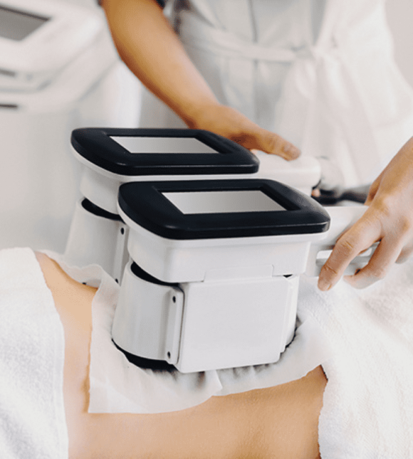 coolsculpting treatment