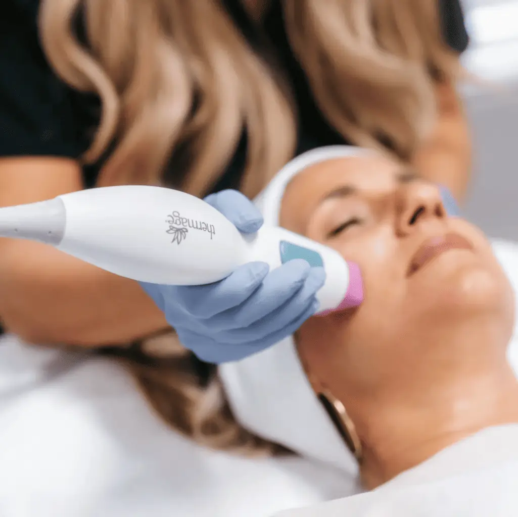 Thermage treatment