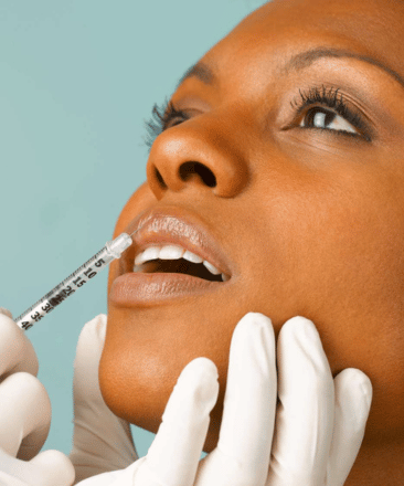 Dermal Filler