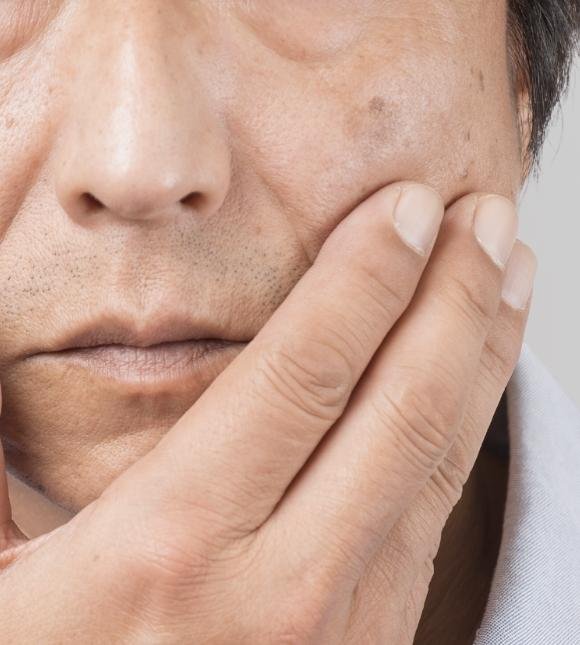 Pigmented Lesions