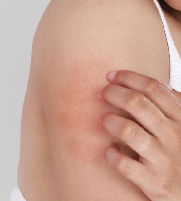 Sensitive Skin