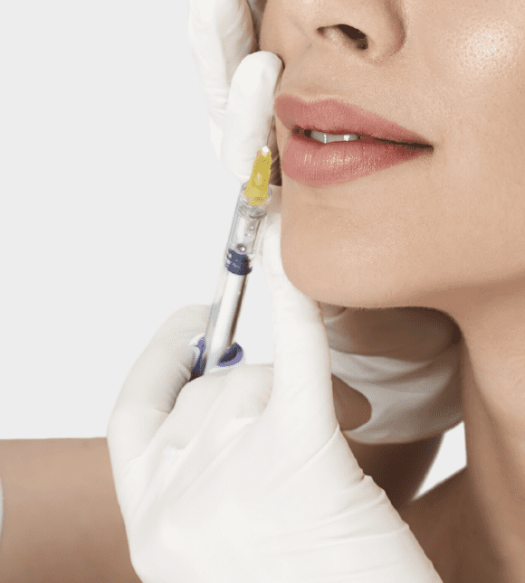 dermal filler 1