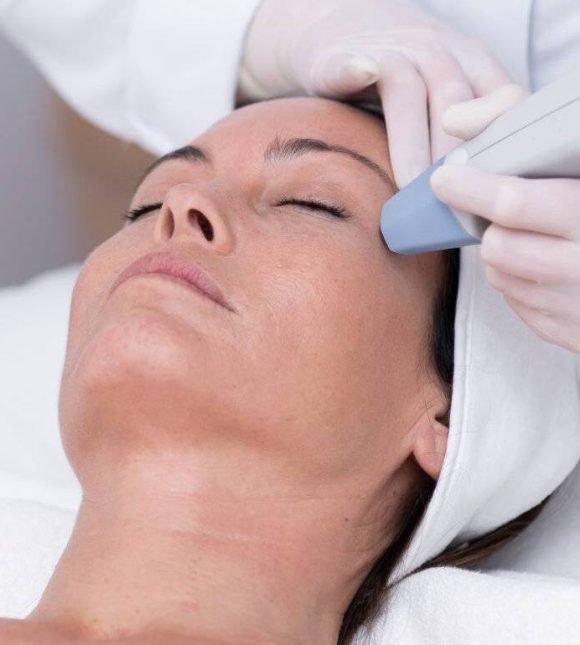 Signature Cosmetic Clinic Exilis Ultra 360
