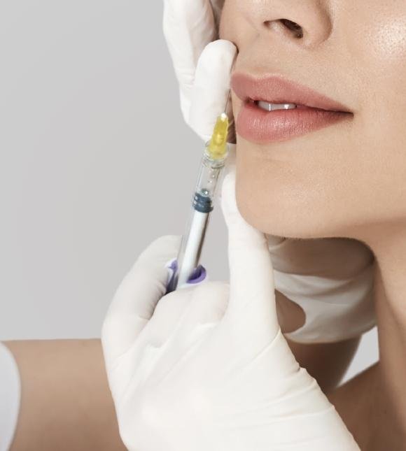 lips augmentation