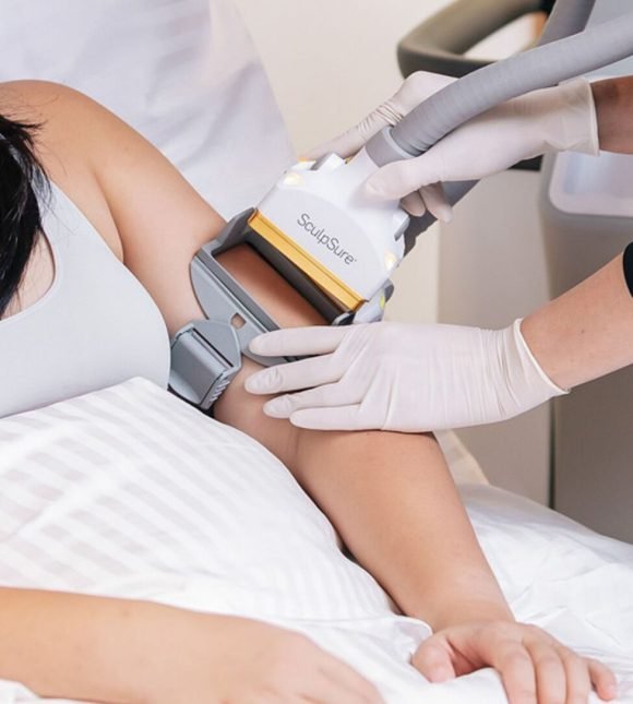 signature cosmetic clinic sculpsure