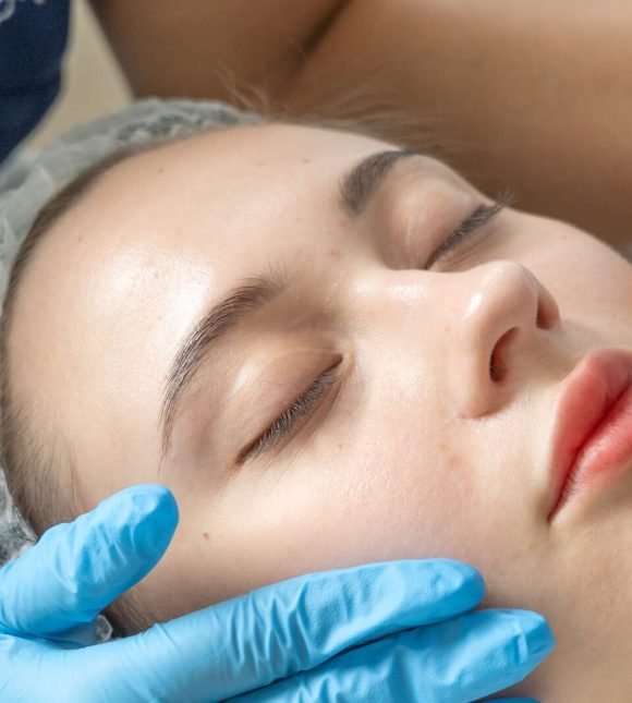 thermage skin lifting