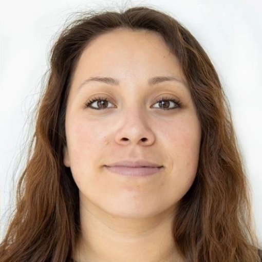 HydraFacial MD after 1