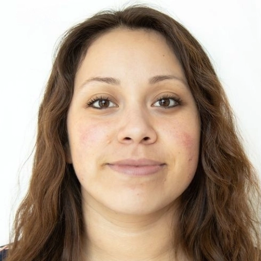 HydraFacial MD before 1