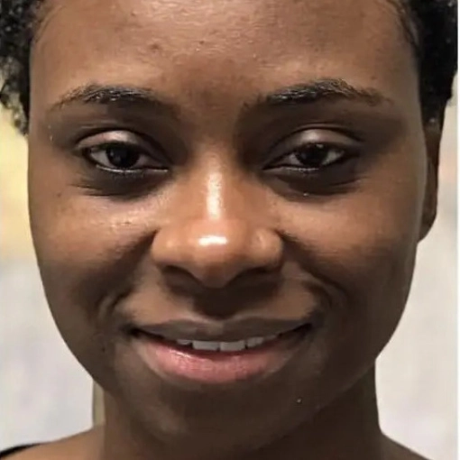 HydraFacial MD before 2