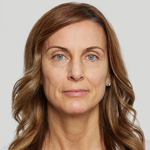 Sculptra® before 4
