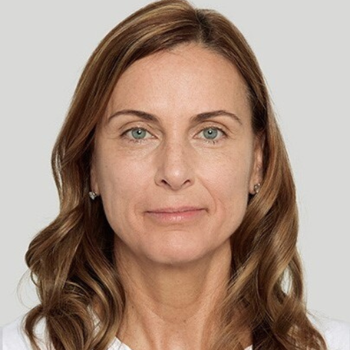 Sculptra®after 4