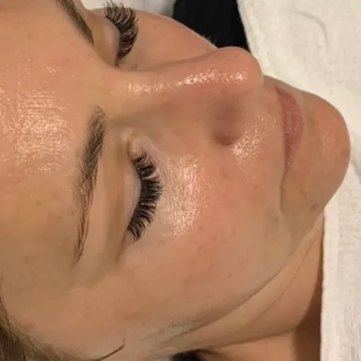 glass facial after 3