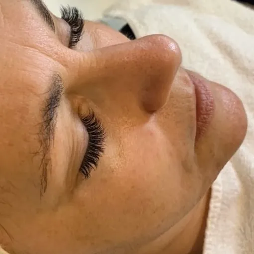 glass facial before 3