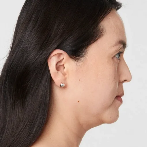 signature cosmetic clinic ultherapy before 2