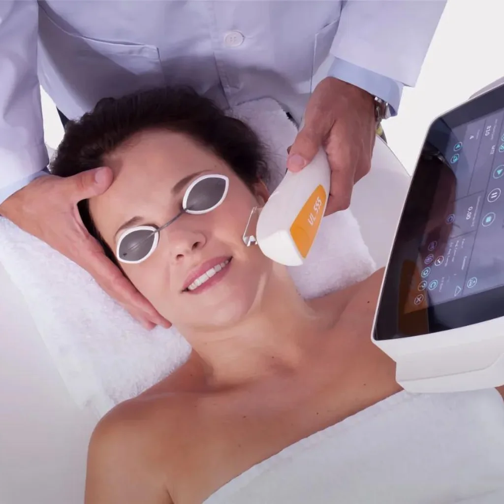 Sun Damage - IPL Therapy
