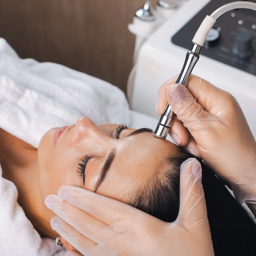 Sun Damage - Microdermabrasion